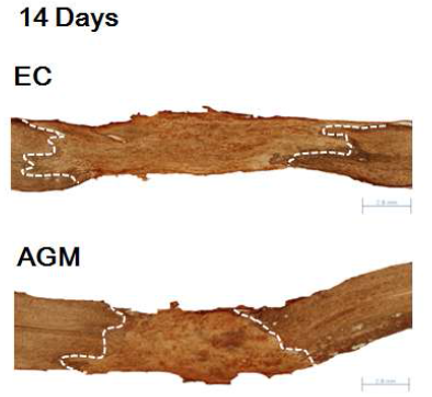 Glial scar formation