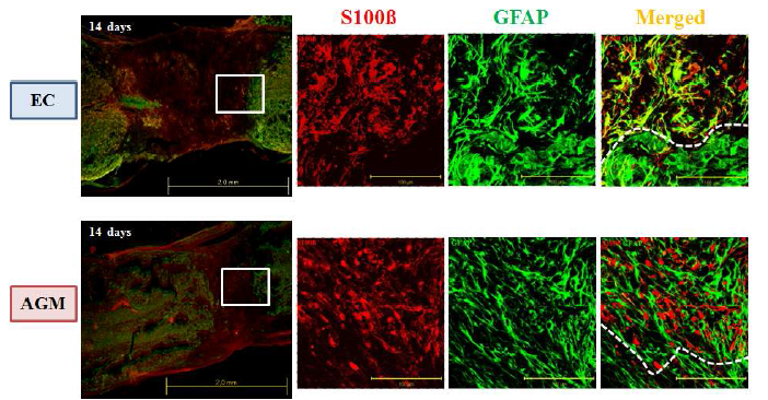 Immunostaining (GFAP. S100β)