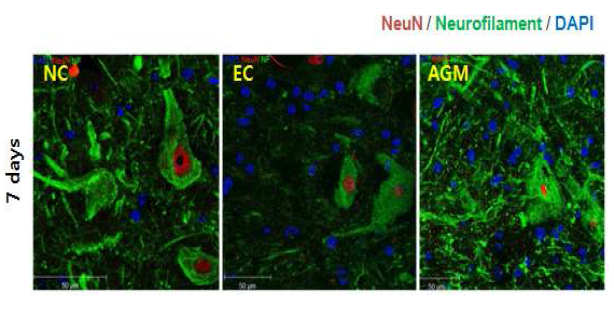 Immunostaining (NeuN. Neurofilament)