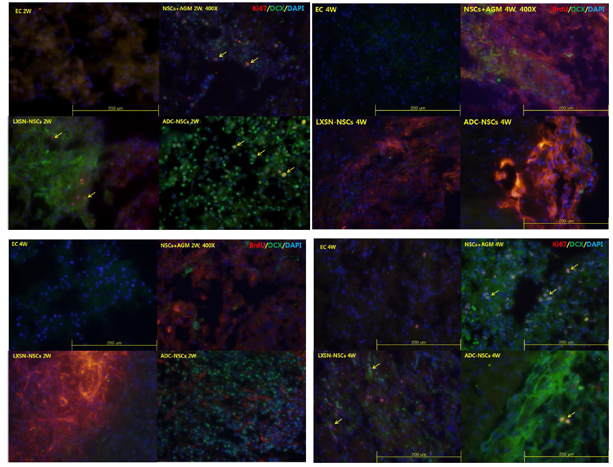 2) Ki67 or BrdU/Doublecortin(DCX) in ischemic area (2week, 4week after MCAO injury)