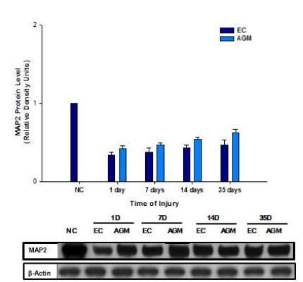 Western blot (MAP-2)