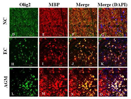 Immunostaining (Olig-2. MBP)