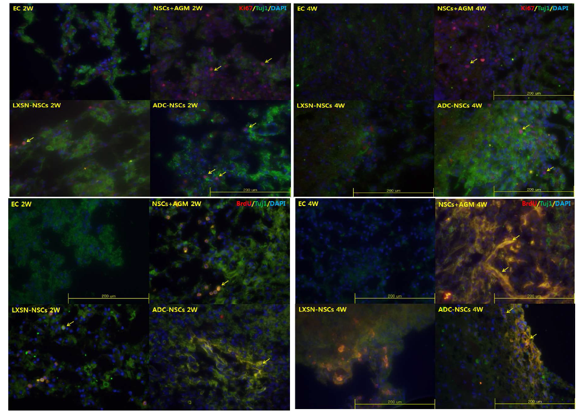 3) Ki67 or BrdU/Beta Tubulin(Tuj1) in ischemic area (2week, 4week after MCAO injury)