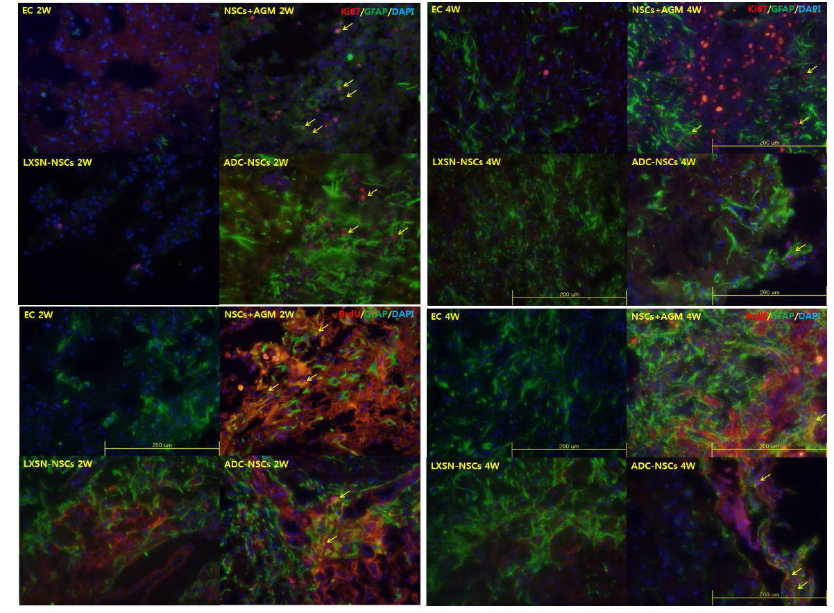 4) Ki67 or BrdU/GFAP in ischemic area (2week, 4week after MCAO injury)