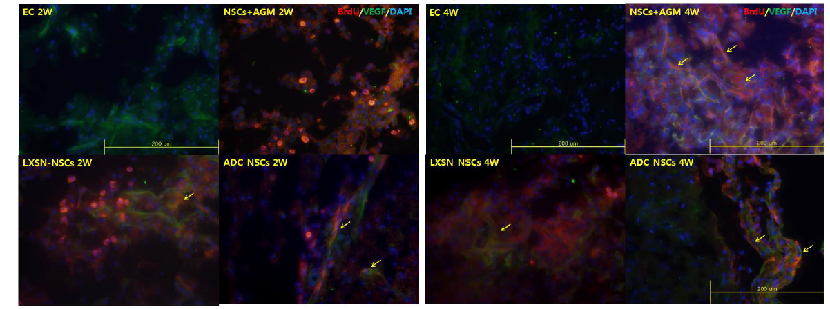 5) BrdU/VEGF in ischemic area (2week, 4week after MCAO injury)