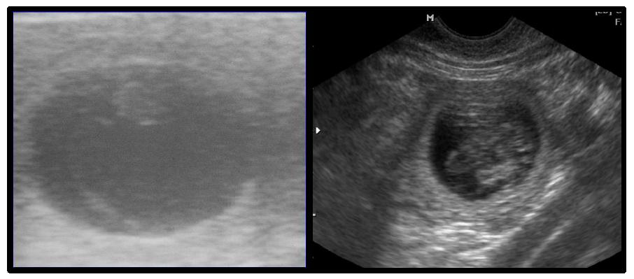 Ultrasonography of a fetus obtained after transfer of cloned dog embryos into a recipient female dog. Aborted fetal vesicle on 25days after embryo transfer (Left), maintained fetal vesicle on day 24 after embryo transfer (Right).