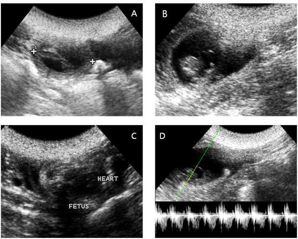 Ultrasonographic images of the fetus.