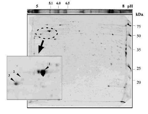 Analysis of two-dimensional electrophoresis using EGCG-sepharose 4B bead.