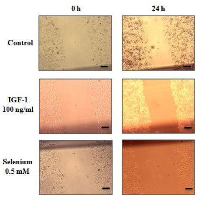 The anti-invasive effect of selenium in Hep3B cells