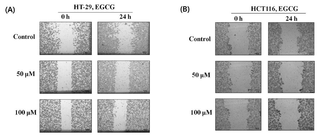 The anti-invasive effect of EGCG in HT-29 and HCT116 cells