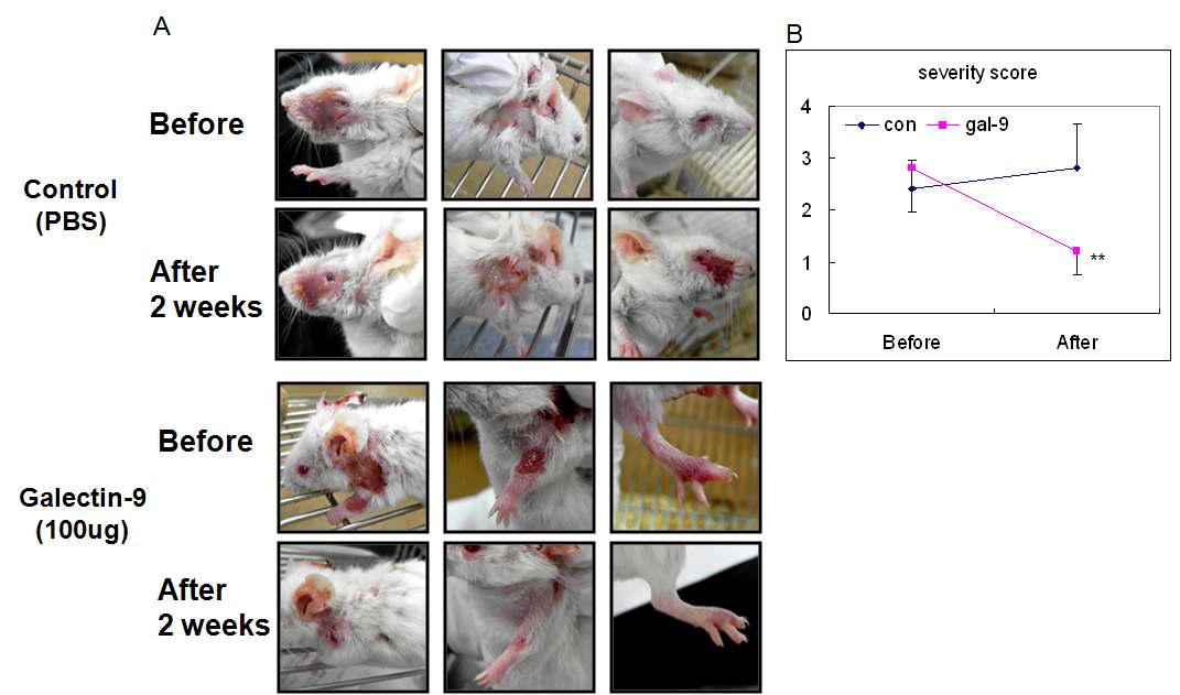 Gal-9 treatment improved BD symptoms.