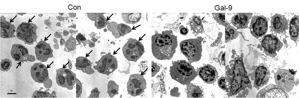 A fter Gal-9 treatment to BD mice, peripheral blood mononuclear cells (PBMC) were isolated from Gal-9 treated BD mice and control treated BD mice and applied to transmission electron microscopy (TEM ). In Gal-9 treated BD mice, neutrophils were rarely found compared to control treated group