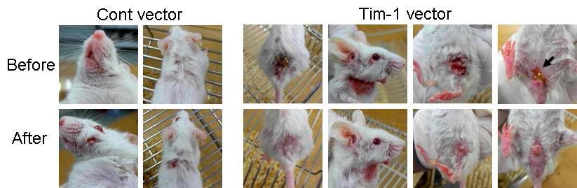The change of cutaneous symptoms in BD mice after injection of Tim1 expression vector