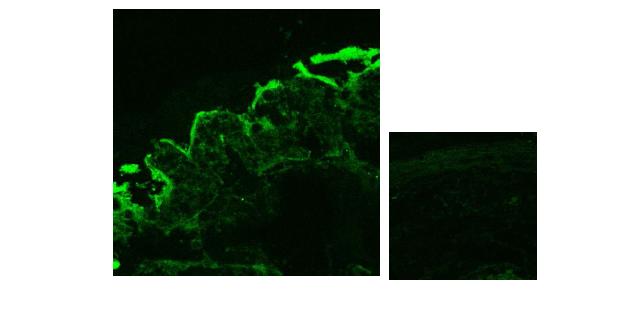 정상 인체 편도조직의 γδ T 세포의 면역형 광염색. 편도선의 상피세포층에 형광에 양성을 보이는 γδ T 세포를 확인함.