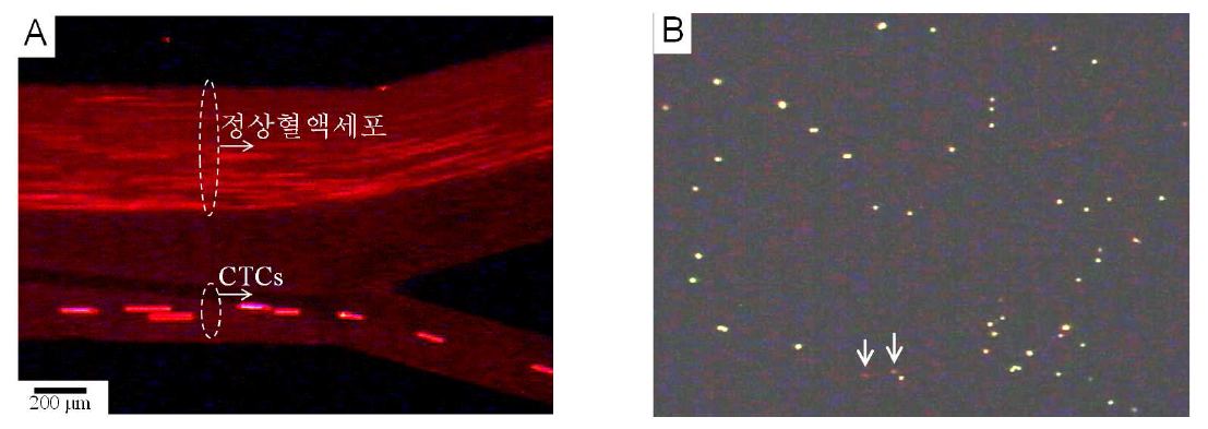 (A) 형광염색된 CTCs(녹색)와 정상유핵세포(적색)가 측면방향 자기 영동에 의해 출구 1번으로 분리되는 모습. (B) 출구 1번으로 분리된 형광염색된 CTCs와 정상유핵세포(↓표시).