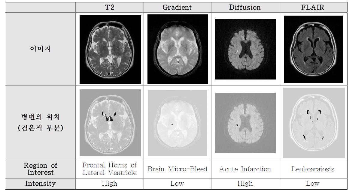 MR 영상 타입별 차이