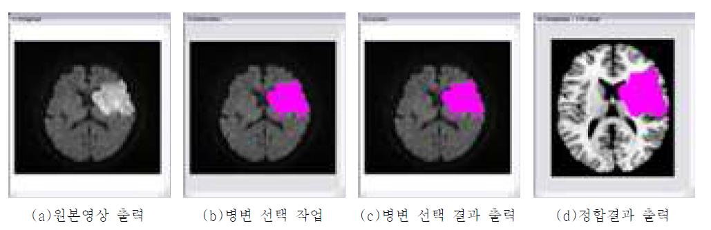 뷰어 부분의 구성