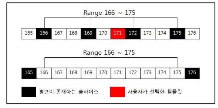 템플릿 범위 필터링의 예. 171번 슬라이스를 선택 시