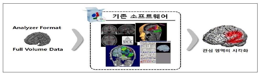 임상시험과 해외 뇌 구조 분석 소프트웨어