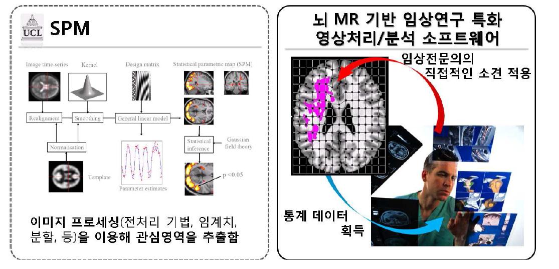 SPM과 본 연구에서 제안하는 소프트웨어의 근본적인 병변선택 방식의 차이점