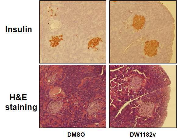 DW1182v의 db/db 마우스 췌도 파괴 억제 효과를 보여주는 췌장 조직 절편 사진