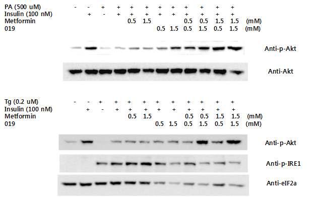 metformin은 HepG2 세포에서 GGBC-100-000-019의 palmitic acid에 의한 인슐린 저항성 (상)과 thapsigargin에 소포체 스트레스 및 인슐린 저항성 (하) 억제 효과에 상승작용을 함.