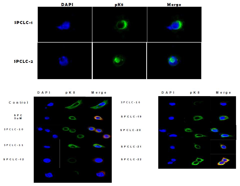 SPCLC에 의한 perinuclear keratin reorganization