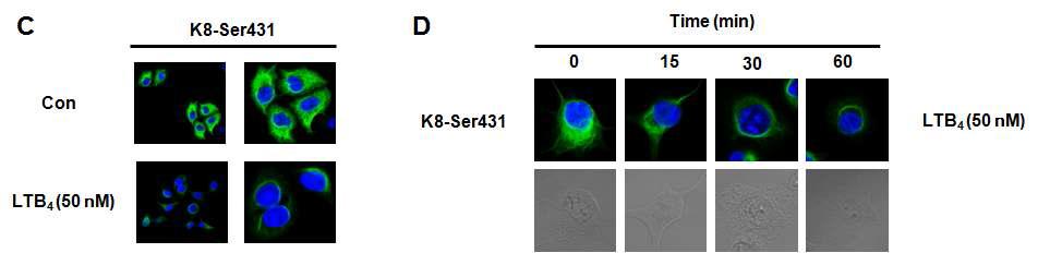 LTB4에 의한 PANC-1 세포에서의 Keratin 8의 perinuclear reorganization