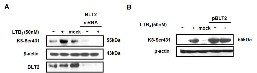 BLT2 gene silencing 및 BLT2의 발현에 의한 Keratin 8의 phosphorylation 에 미치는 영향
