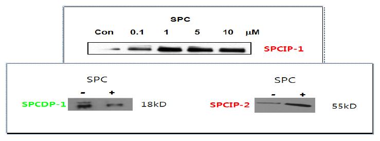 SPCIP1, 2, SPCDP1의 western blot으로의 발현정도 확인