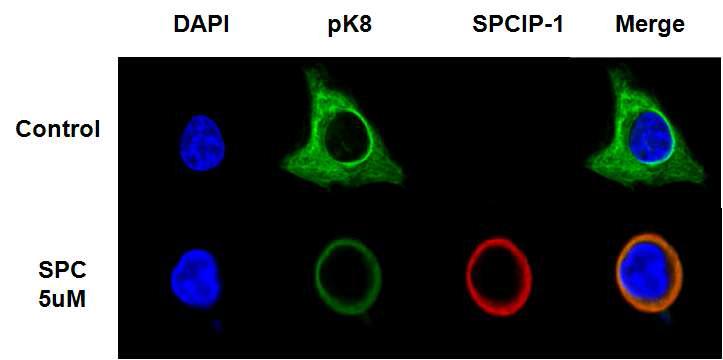 SPCIP1 confocal microscopy에 의한 발현 확인