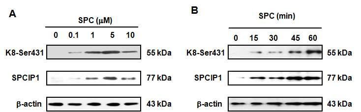 SPC에 의한 SPCIP1 발현 확인