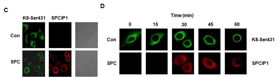 SPC에 의한 confocal microscopy를 이용한 SPCIP1 발현 확인