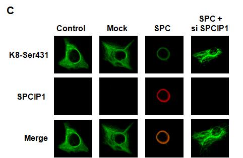 Keratin reorganization에 미치는 SPCIP1의 영향