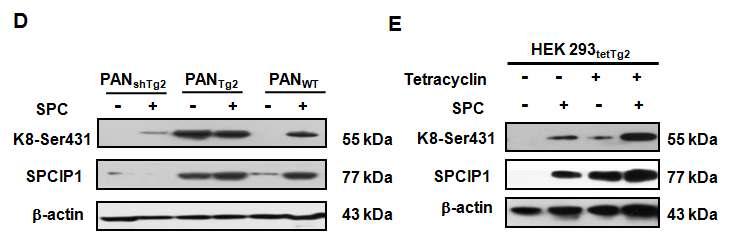 Keratin 인산화에 미치는 SPCIP1의 영향