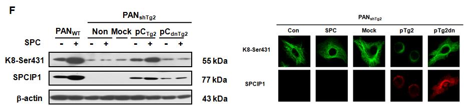 Keratin 인산화 및 재구축에 미치는 SPCIP1의 활성