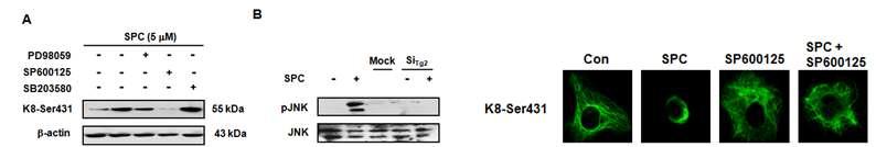 SPC에 의한 keratin 인산화에 미치는 신호전달 경로