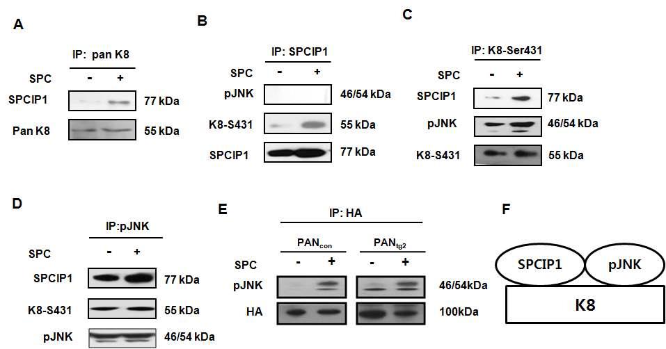 SPCIP1과 pJNK의 complex 형성