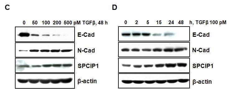 TGF-b에 의해 유발된 EMT에서의 SPCIP1의 발현