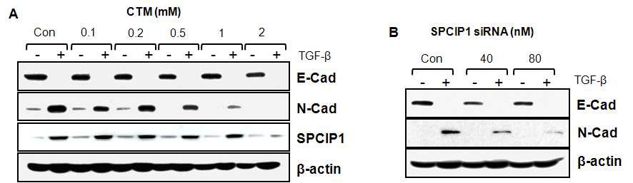 TGF-b 유발 EMT에서의 SPCIP1의 관여