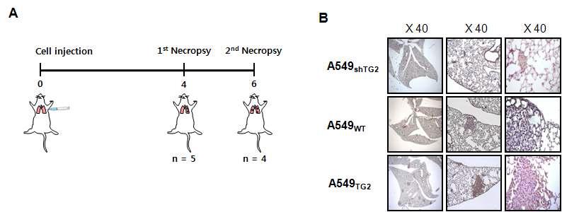 SPCIP1의 발현 차이가 나는 A549세포주를 이용한 lung orthotopic model