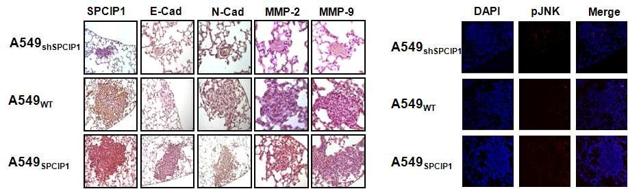 SPCIP1의 발현 차이에 따른 A549세포주를 이용한 lung orthotopic model에서의 EMT marker의 확인