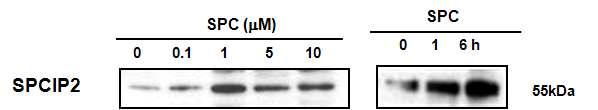 SPC에 의한 SPCIP2의 발현 확인
