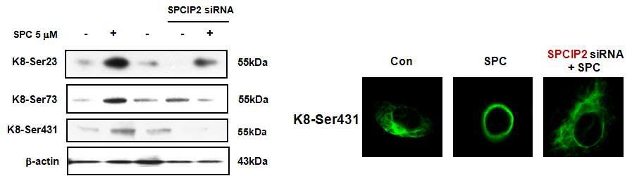 SPC에 의한 keratin의인산화 및 reorganization에 미치는 SPCIP2의 관여가능성 확인