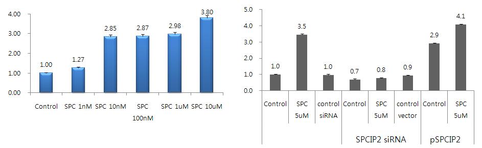 SPCIP2가 세포의 침윤에 미치는 영향