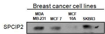 유방암세포주에서의 SPCIP2의 발현 정도 확인