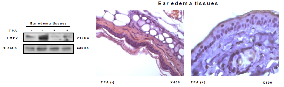 TPA ear edema 모델에서 SPCDP1의 발현의 감소를 보여주는 western blot 및 조직사진