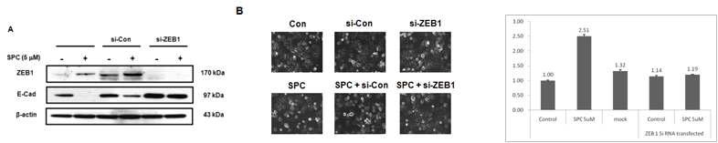 SPC에 의한 ZEB1의 발현 확인 및 EMT에 미치는 영향