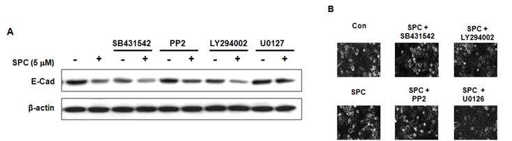 SPC에 의한 E-cadherin의 감소에 미치는 신호전달경로의 kinase 억제제의 영향