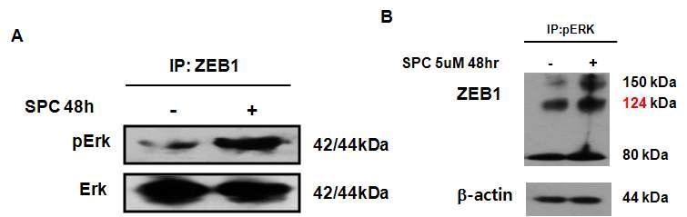 ERK와 ZEB1 간의 상호작용